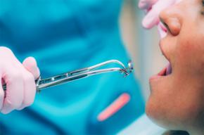 La endodoncia salvaguarda la salud dental y la calidad de vida